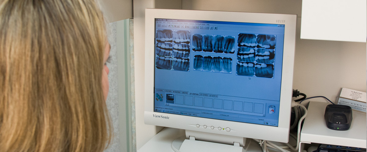Digital X-rays